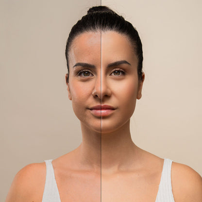 Massageador Facial Reafirmante com LED, EMS e Calor Selora – Rosto e Pescoço
